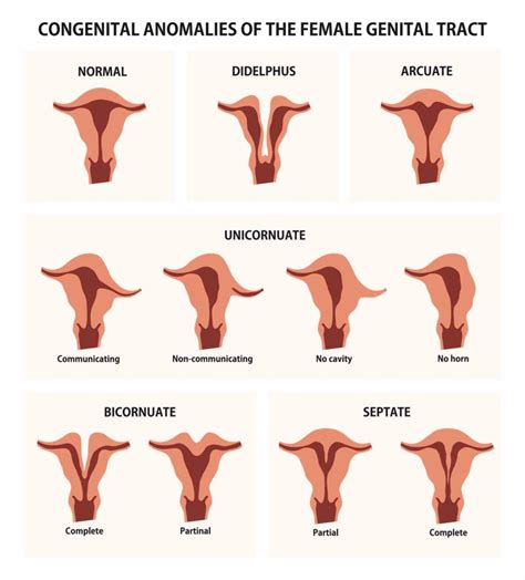 indian teen pussy|Lopsided Vagina: 9 Different Labia Shapes, Colors, and Sizes